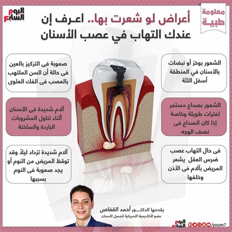 أسباب ألم عصب الأسنان