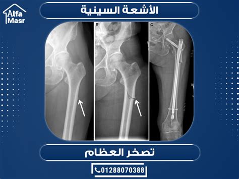 احصائيات أسعار الأشعة السينية X ray في مصر