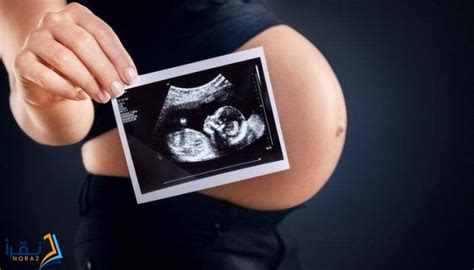 تعرفى على مين سوت اشعه تعرف نوع الجنين في شهر الثالث وتعرف على النتائج، كثيرا من النساء الحوامل يثير فضولها بشكل كبير معرفة ما جنس المولود