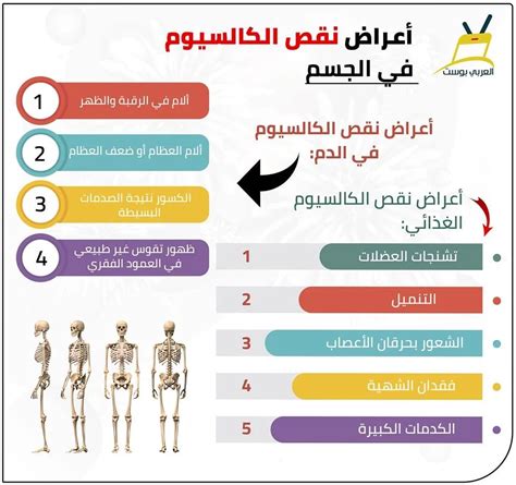 علامات ارتفاع نسبة الكالسيوم