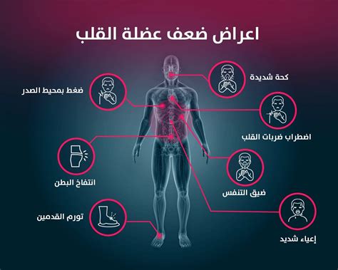 ما هي أعراض الإصابة بمرض ضعف عضلة القلب