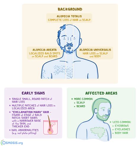 Alopecia Universalis Diagnosis