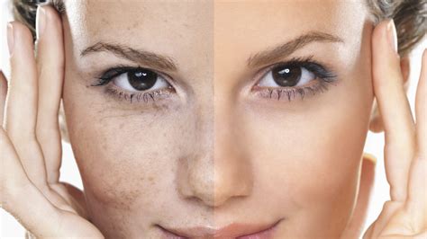 Anti aging kremler ne işe yarar