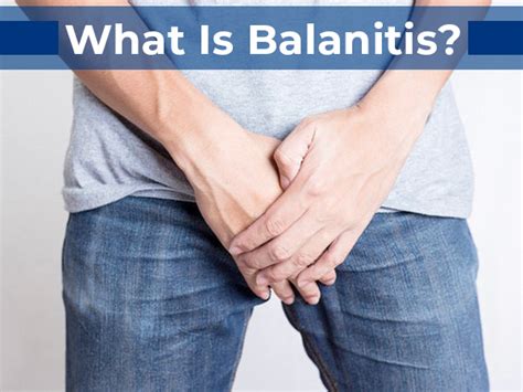 Balanitis Pictures Treatment