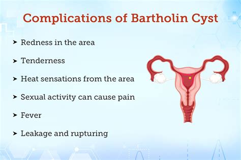 Bartholin Glands Cysts Medical Pictures