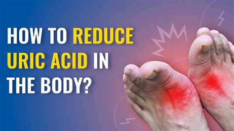 Can High Uric Acid Cause Kidney Damage