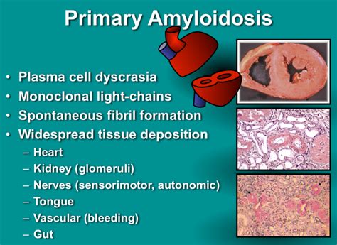 Explain What Amyloid Plaques Are