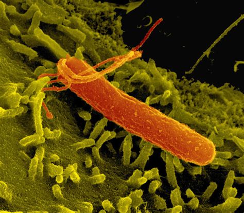 Helicobacter pylori ekşi