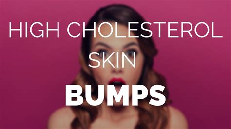 High Cholesterol Skin Bumps