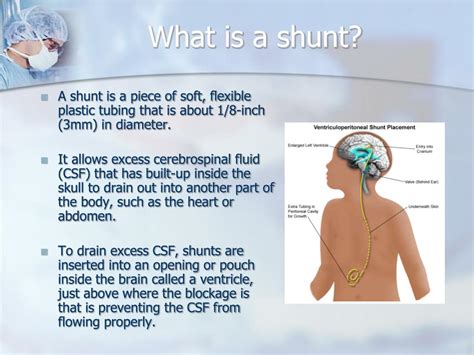 How Does A Shunt Work