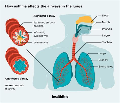 How Does Asthma Affect Breathing