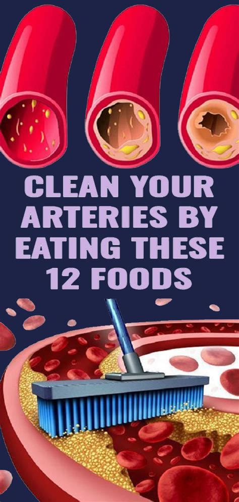 How To Clean Your Arteries Of Plaque