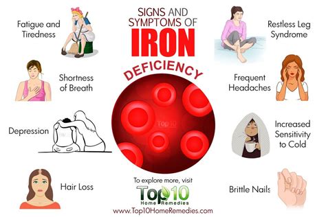 Iron Deficiency And Vision