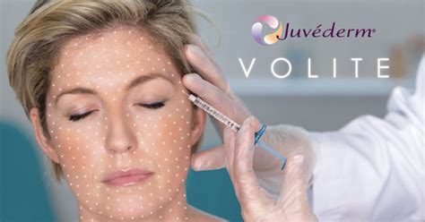 Juvederm volite yaptıranlar