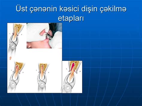 Kivi kartından çəkilmə vaxtı