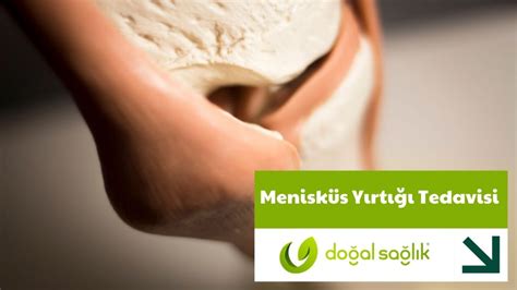 Menisküs yırtığı doğal tedavi