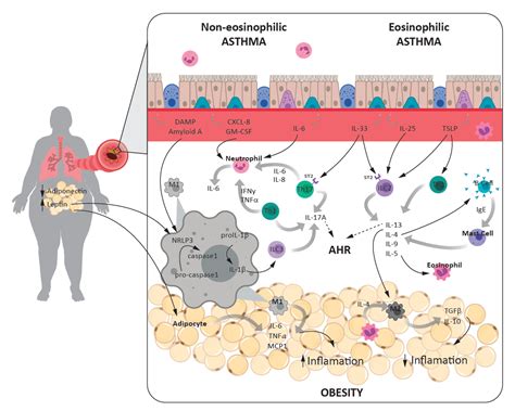 Obese Asthma Hyperreponsiveness Fibrosis Remodeling