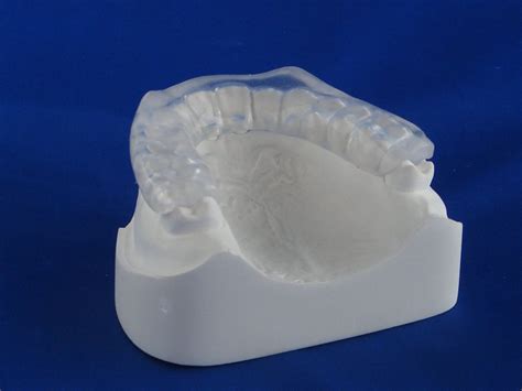 Occlusal Guard With Anterior Ramp