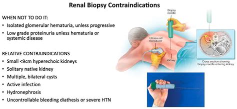 Renal Biopsy Contraindications