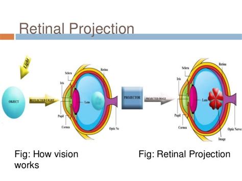 Retinal Projection