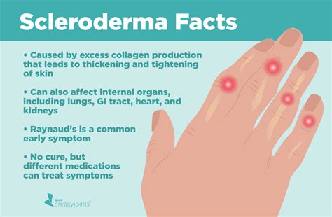 Scleroderma Caused By Collagen Supplements