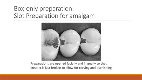 Slot Preparation In Operative Dentistry