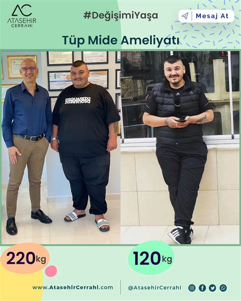 Tüp mide ameliyatı sonrası kusmalar