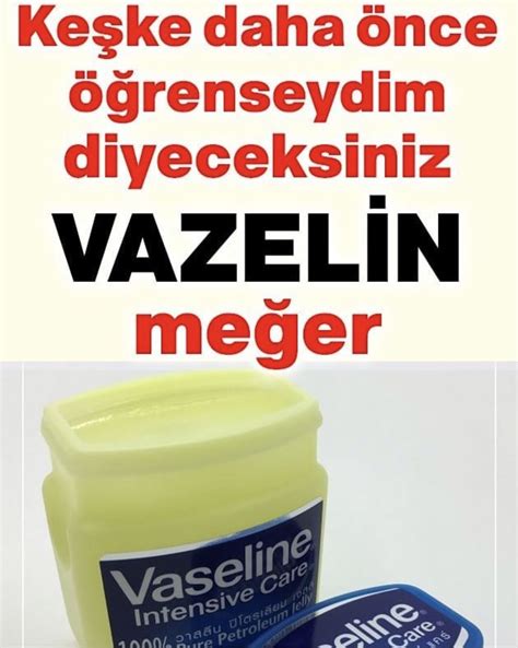 Vazelin nedir